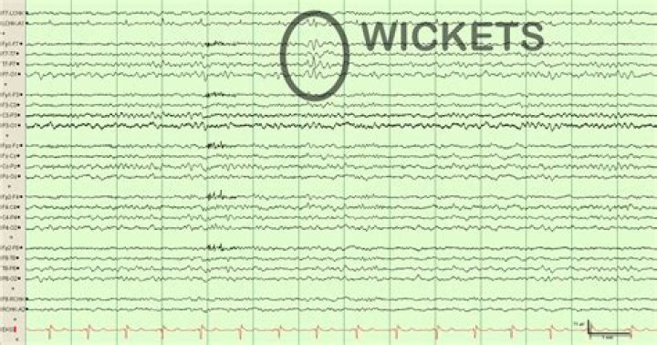 What are wicket spikes